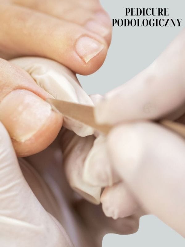Pedicure podologiczny